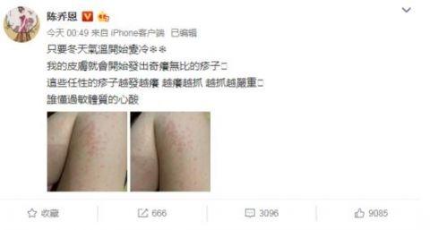 陈乔恩晒过敏 粉丝却劝她多穿点!