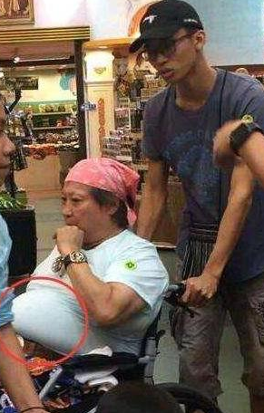 \