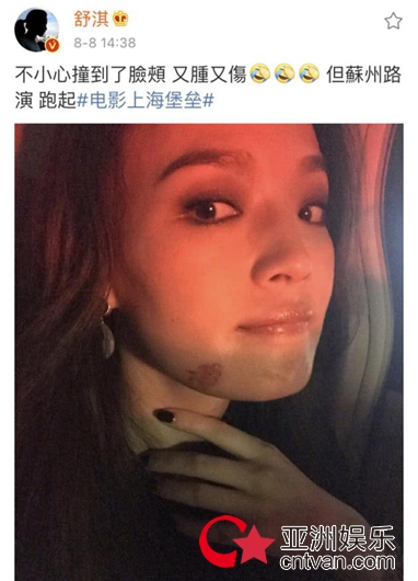 舒淇撞伤脸颊发肿 仍坚持工作被赞敬业