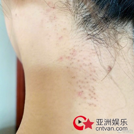 杨紫回应现身整形美容医院 网友:人红是非多!
